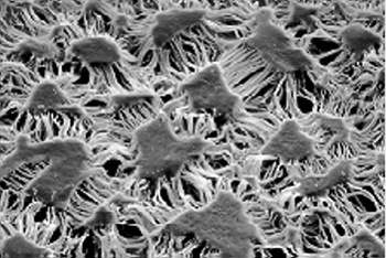 Electron micrograph of a Gore-Tex membrane.