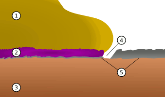 Schematic illustration of the Al-Au purple plague