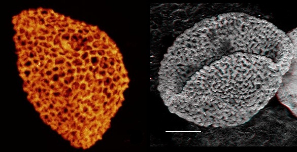 Middle Triassic pollen.