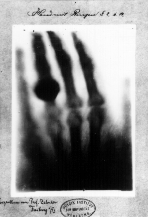 Hand mit Ringen (Hand with Rings), X-ray radiograph by Wilhelm Röntgen of the left hand of his wife