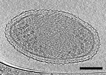 Image of an ultra-small bacteria
