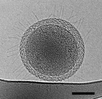 Image of an ultra-small bacteria showing pili-like structures